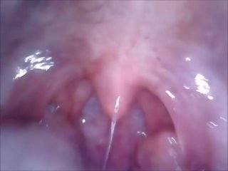 Kamera v usta vagina in rit
